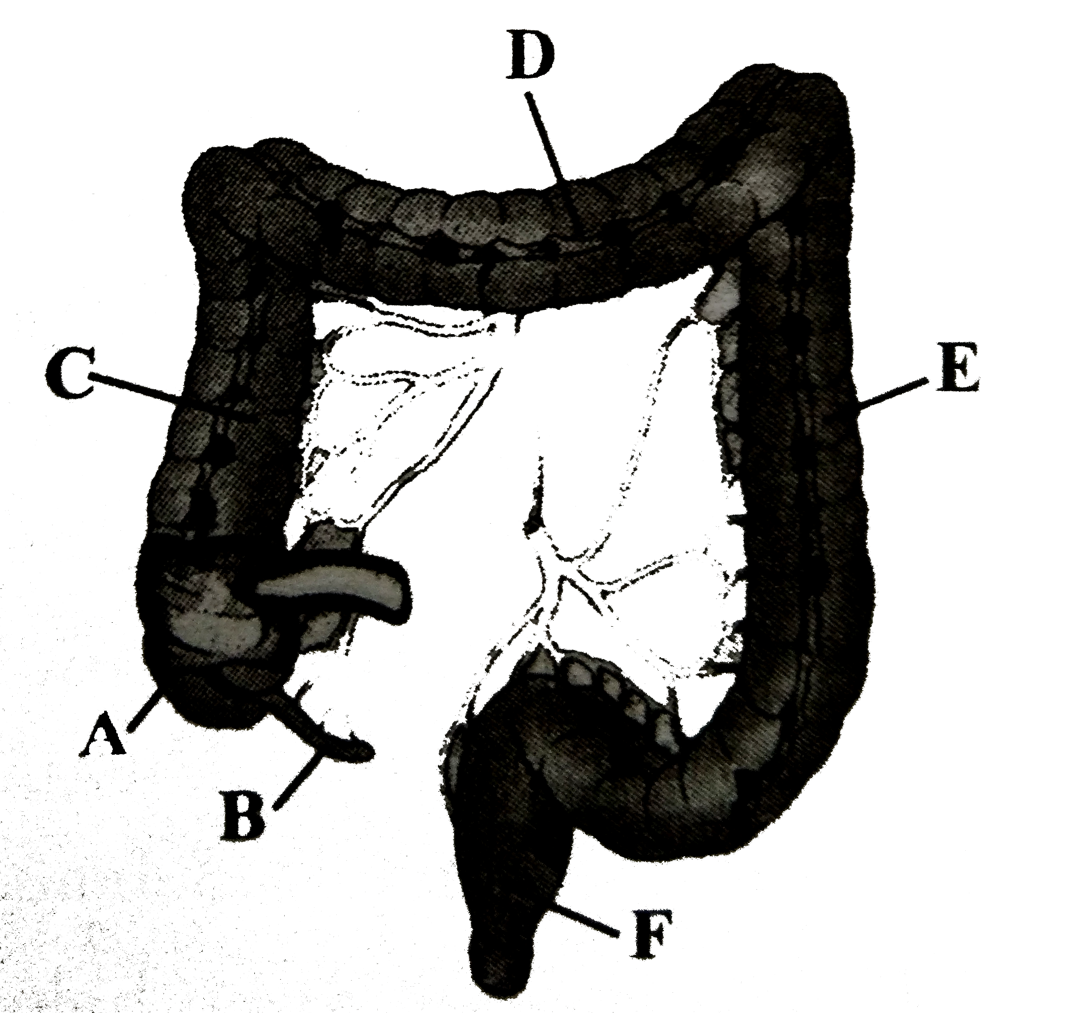 The diagram of large intestine of man is given here. Identify the parts